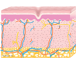 Collagen remodeling